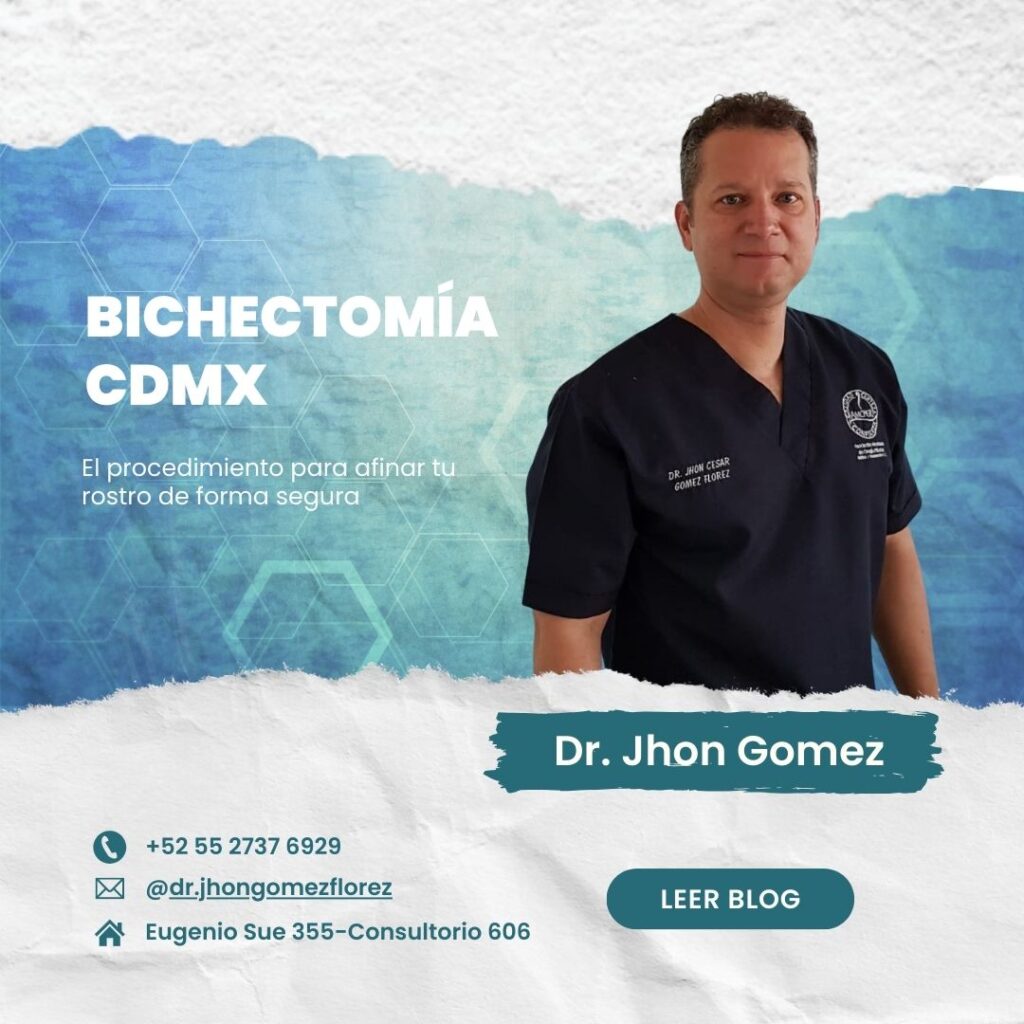 Bichectomía CDMX