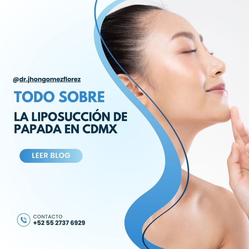 Liposucción de papada