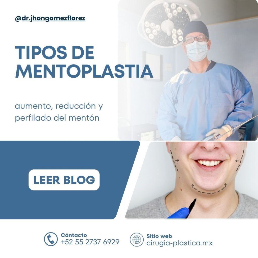 Tipos de mentoplastia