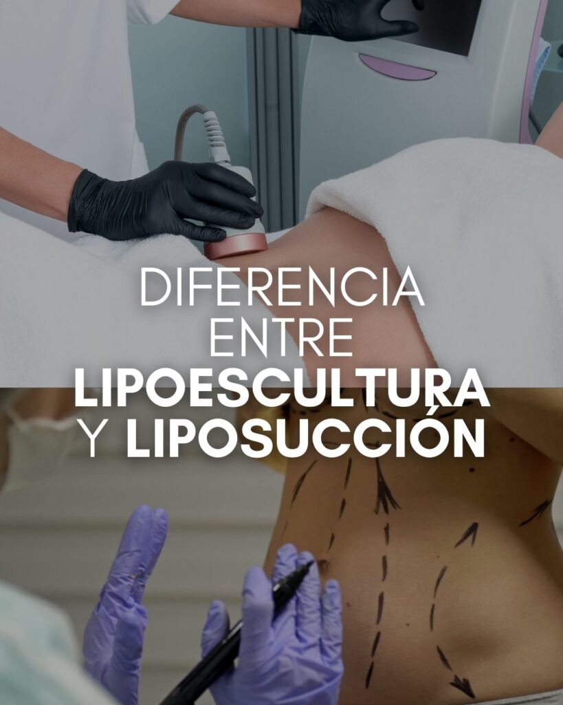 Diferencia entre lipoescultura y liposucción