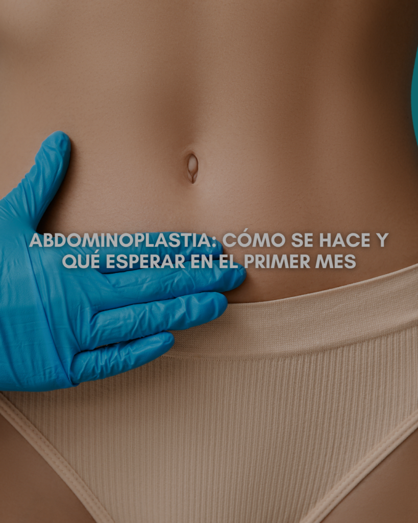 Abdominoplastia