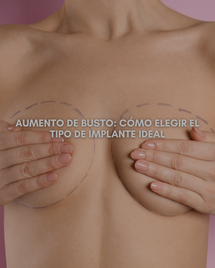 Aumento de Busto