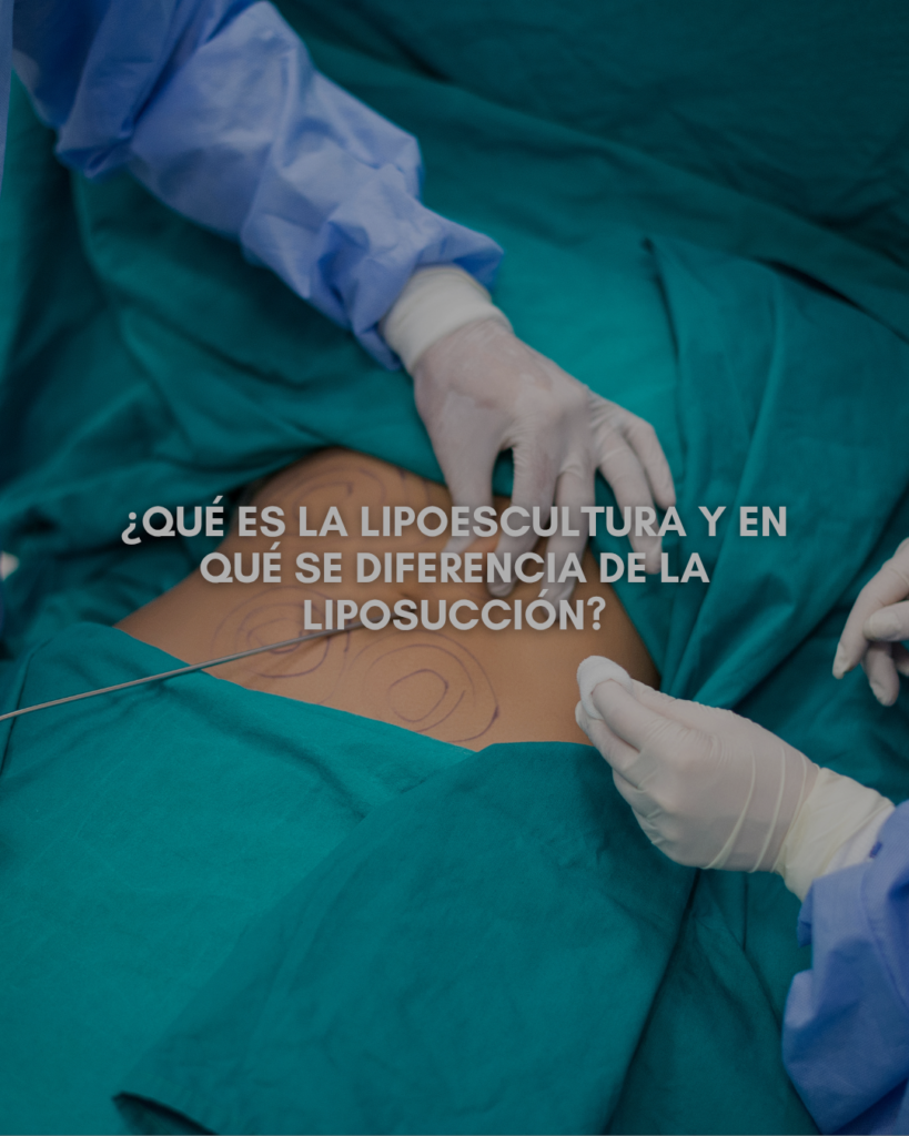 Lipoescultura y Liposucción Lipoescultura y Liposucción