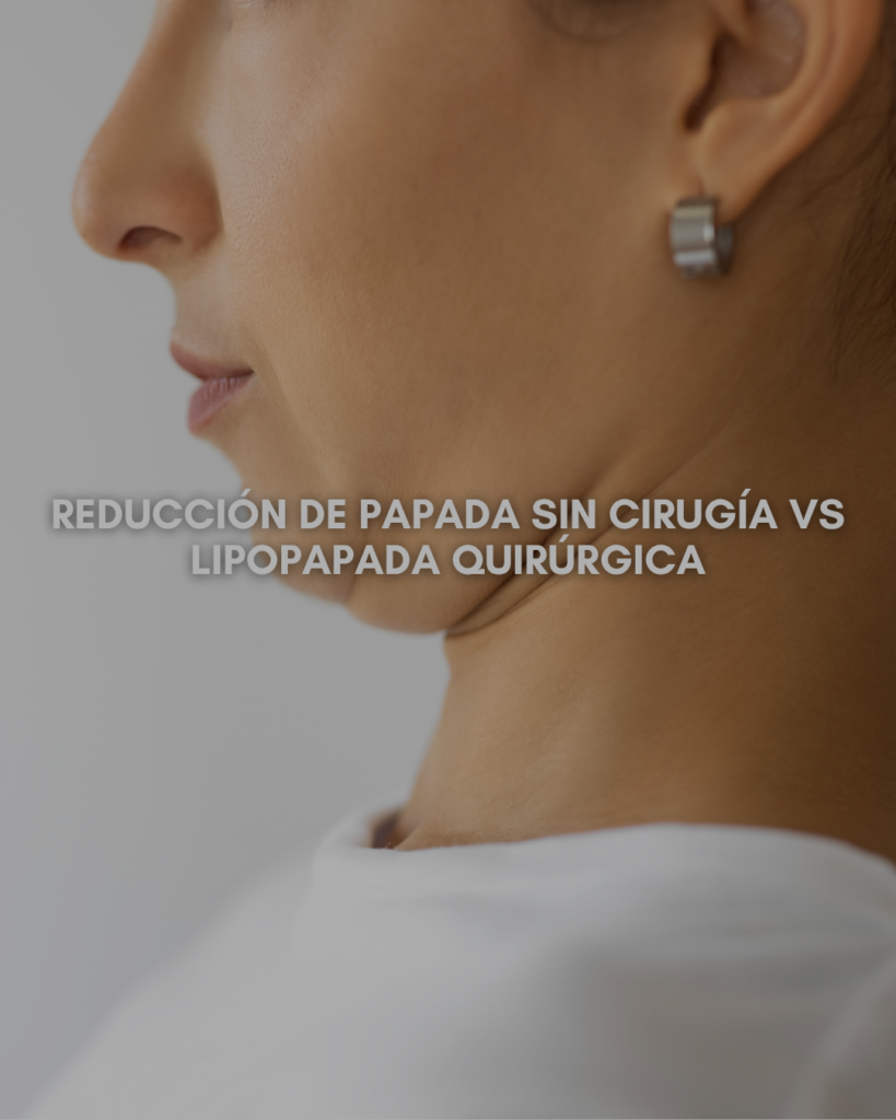 Reducción de papada sin cirugía